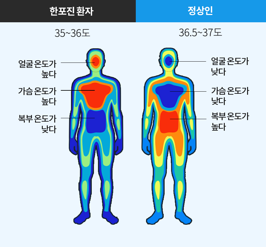 한포진환자 체온