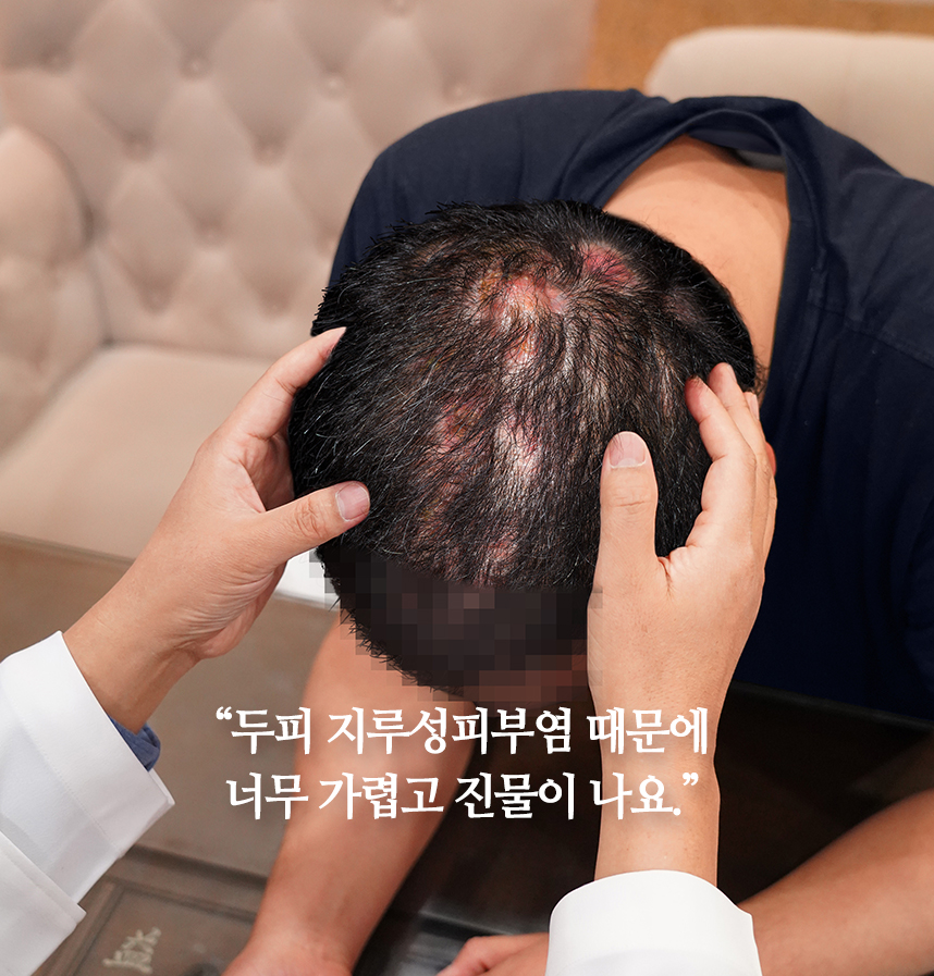 환자 스토리