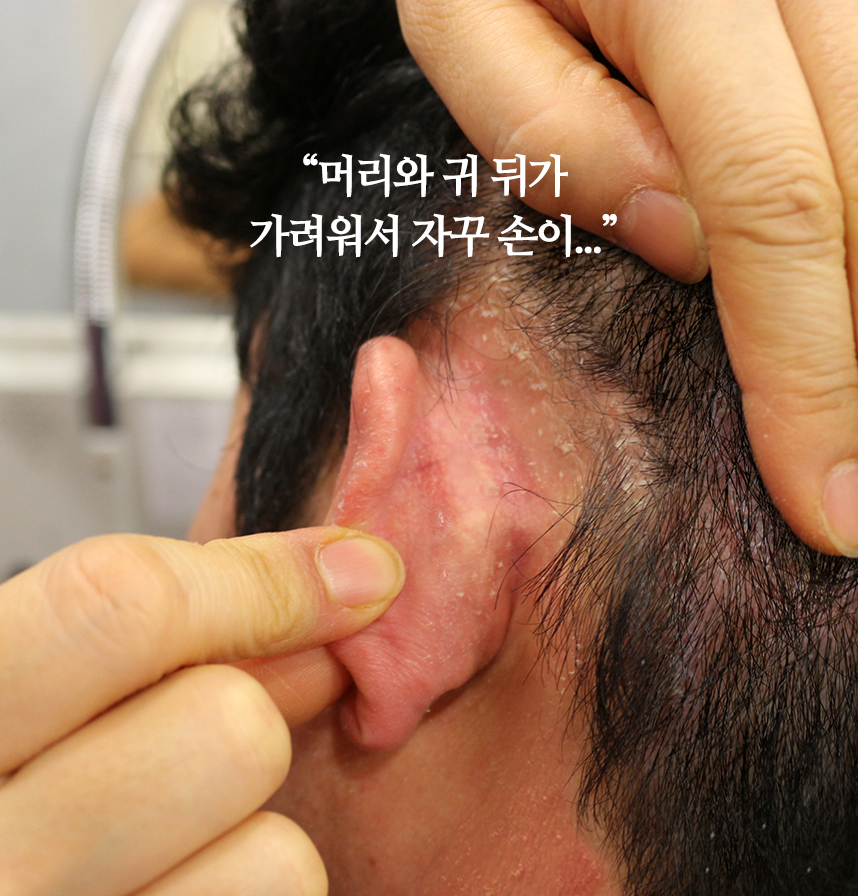환자 스토리