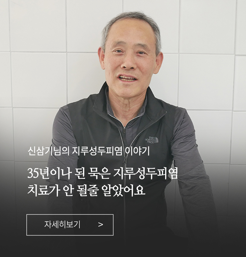 지루성두피염 이야기