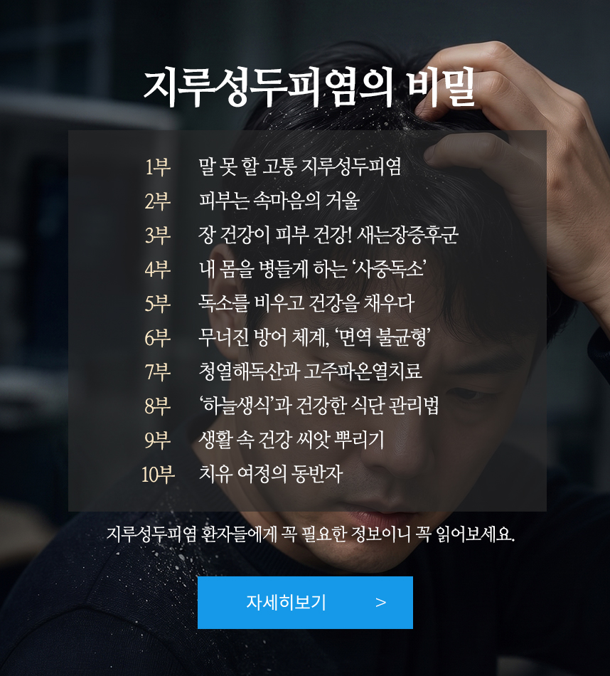 지루성두피염의 비밀 10부작