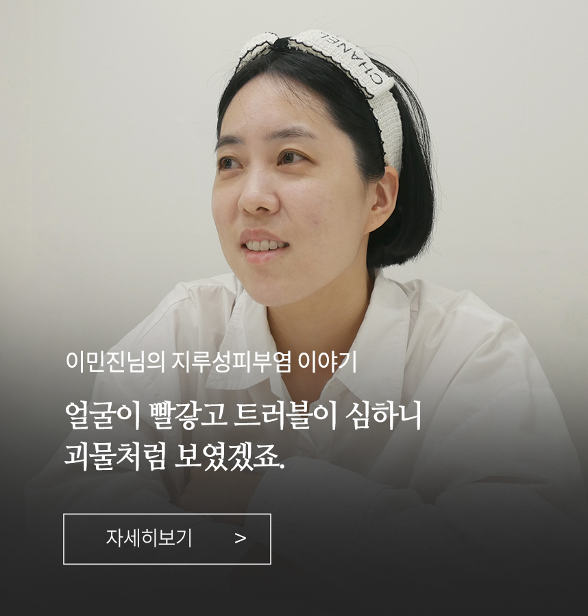 지루성피부염 이야기