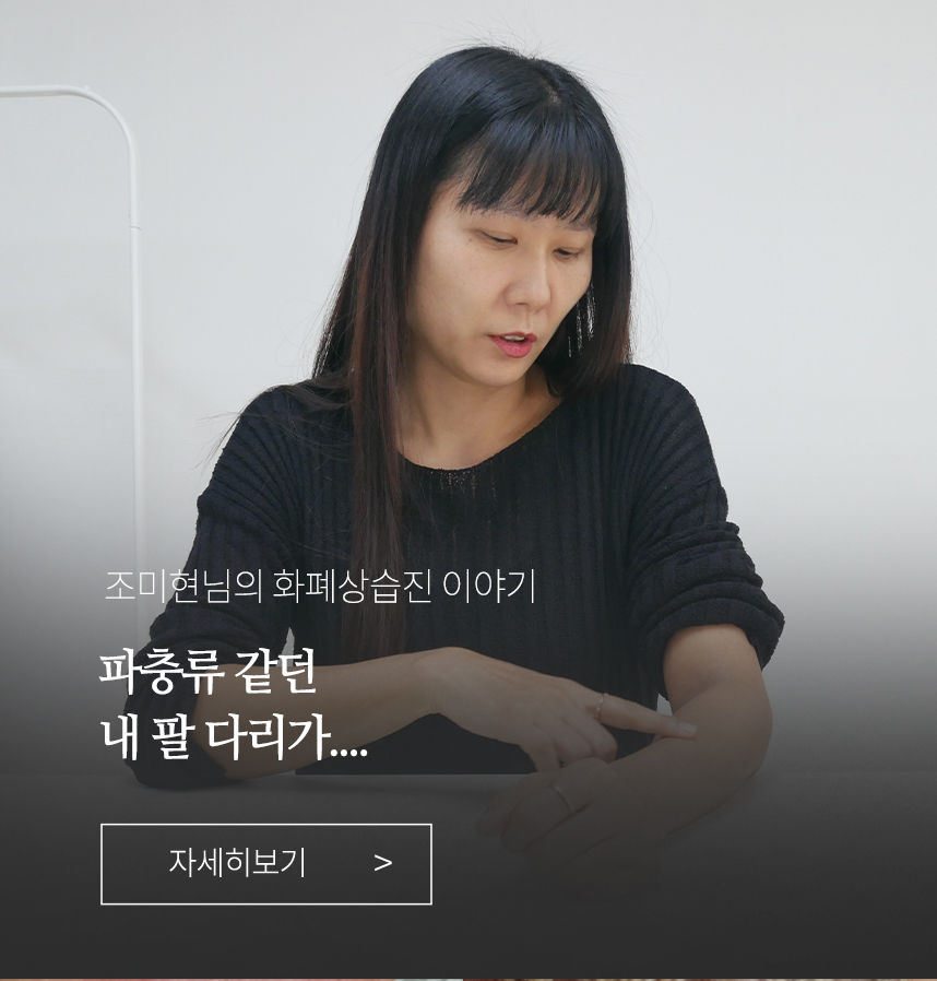 화폐상 습진 이야기