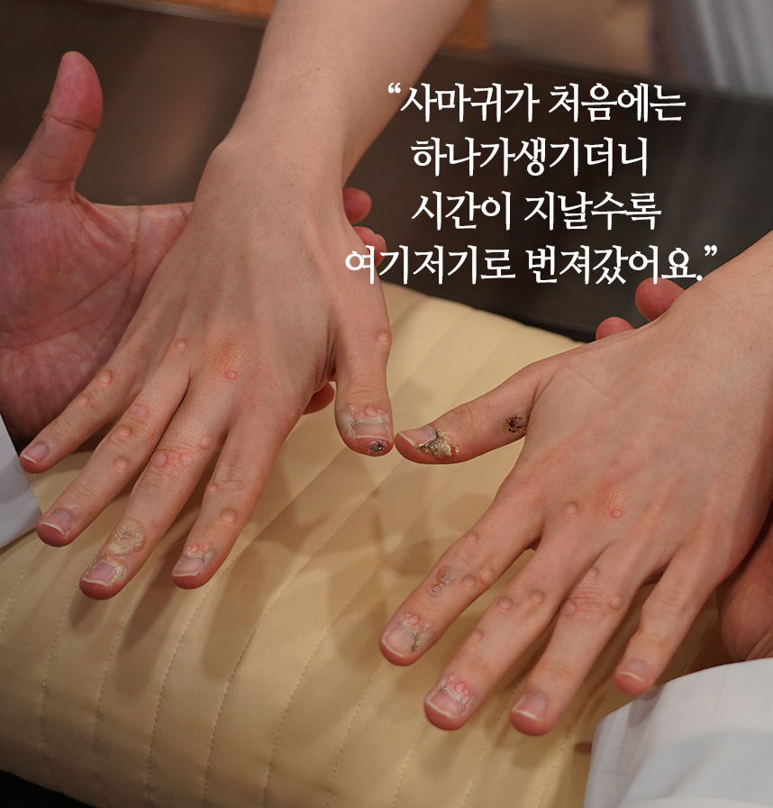 환자 스토리