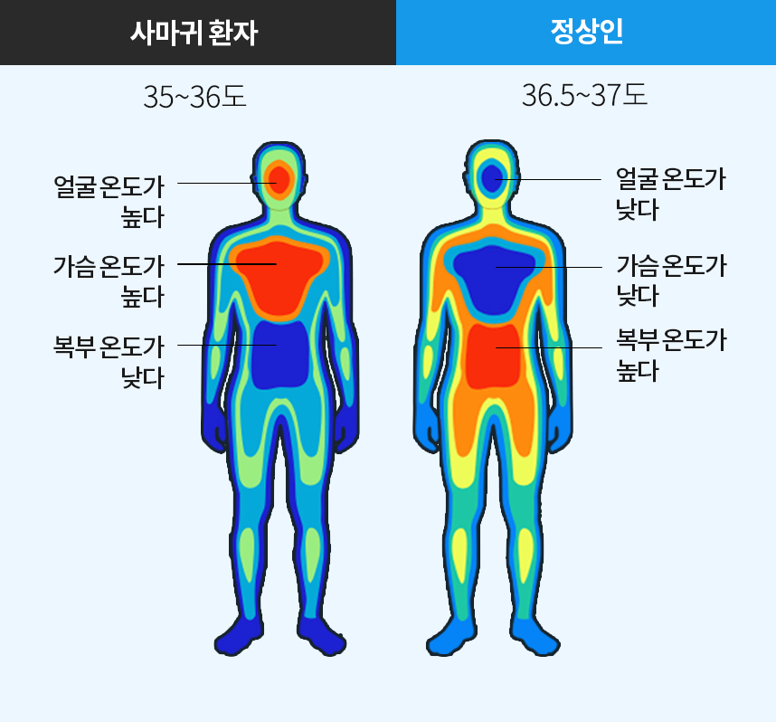 사마귀환자 체온