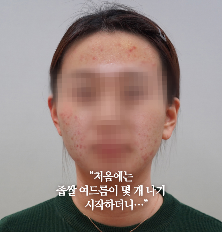 환자 스토리