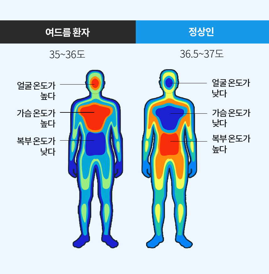 여드름환자 체온