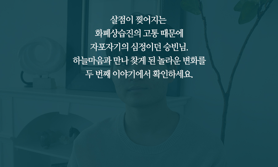 치료전후보기