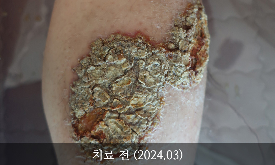 인터뷰 이미지