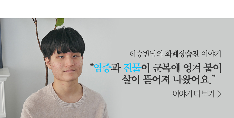 허승빈 화폐상습진 이야기