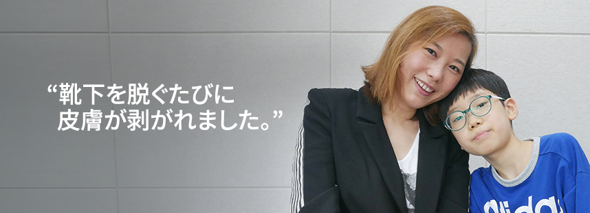 Every time I took off my socks, my skin would peel off.