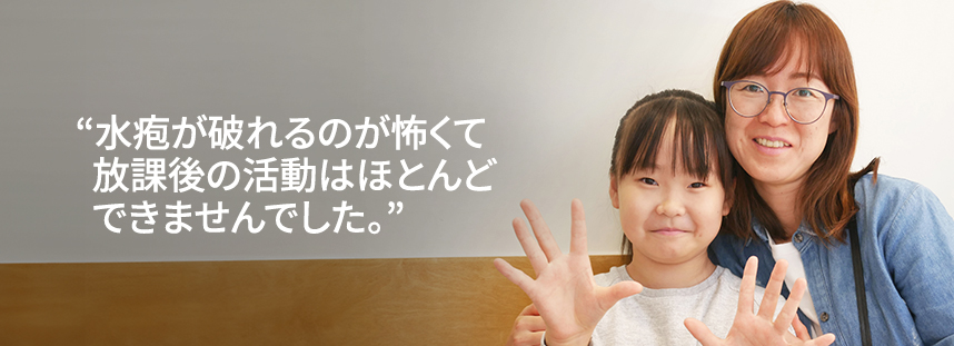 I could hardly participate in after-school activities, afraid the blisters might burst.