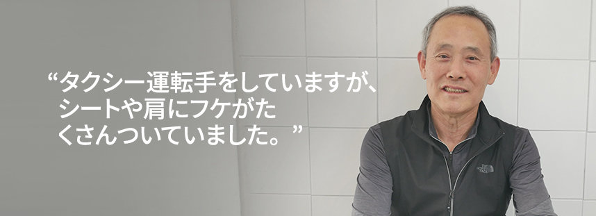 I'm a taxi driver, and my seat and shoulders were covered in dandruff.