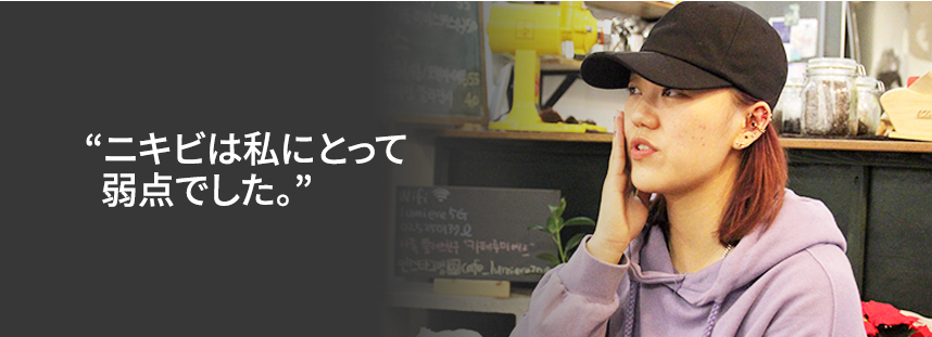 Acne was my biggest weakness.