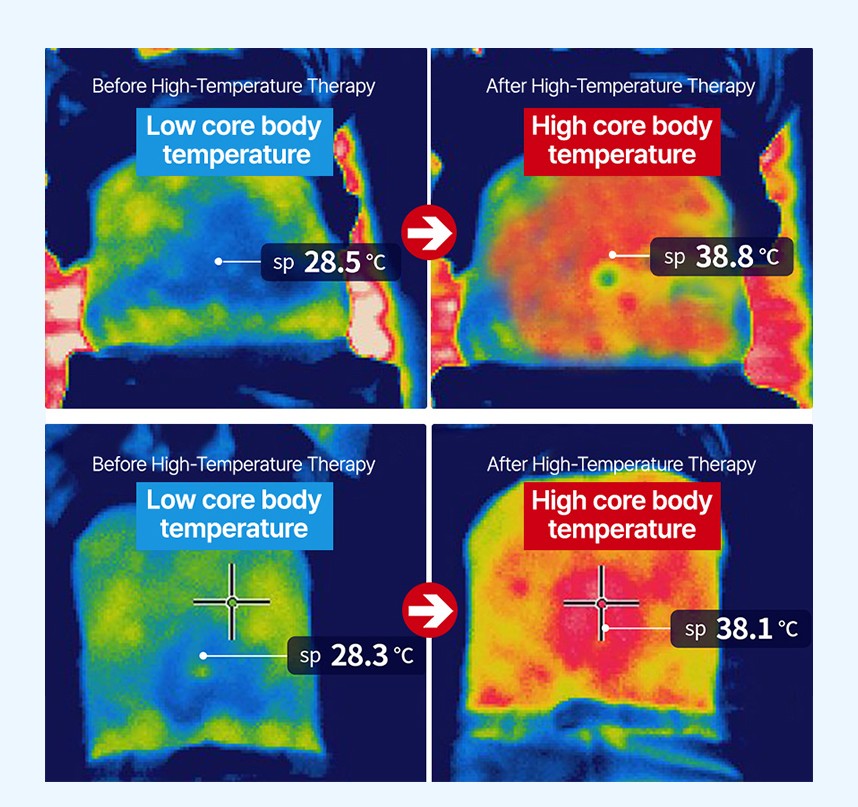 약물도포치료를 받는 아토피환자