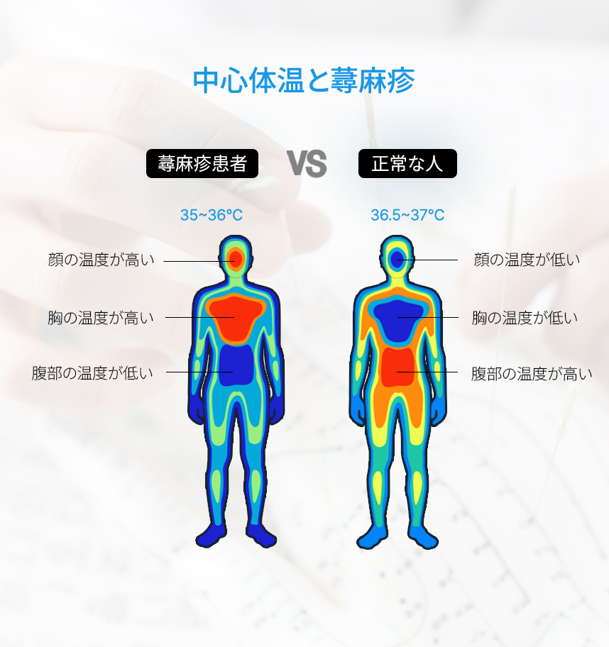 Core Body Temperatureand Urticaria