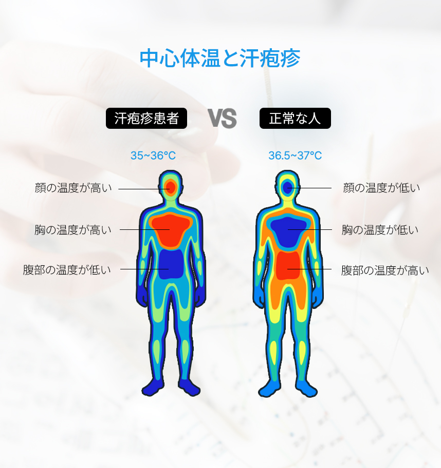 Core Body Temperatureand Dyshidrotic eczema
