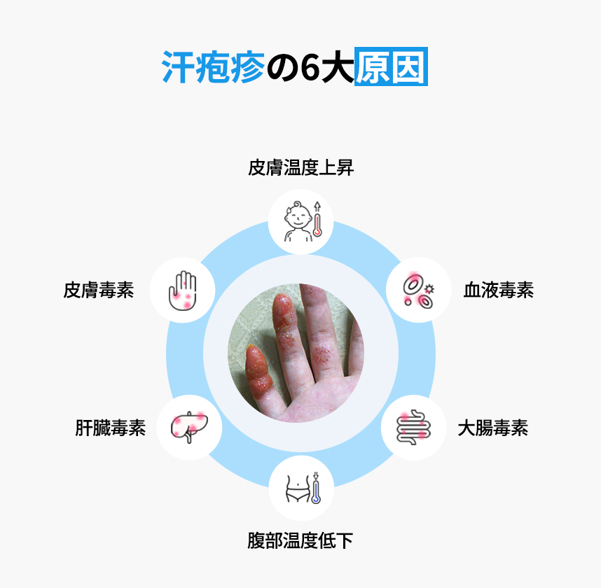 The Six Major Causes of dyshidrotic eczema