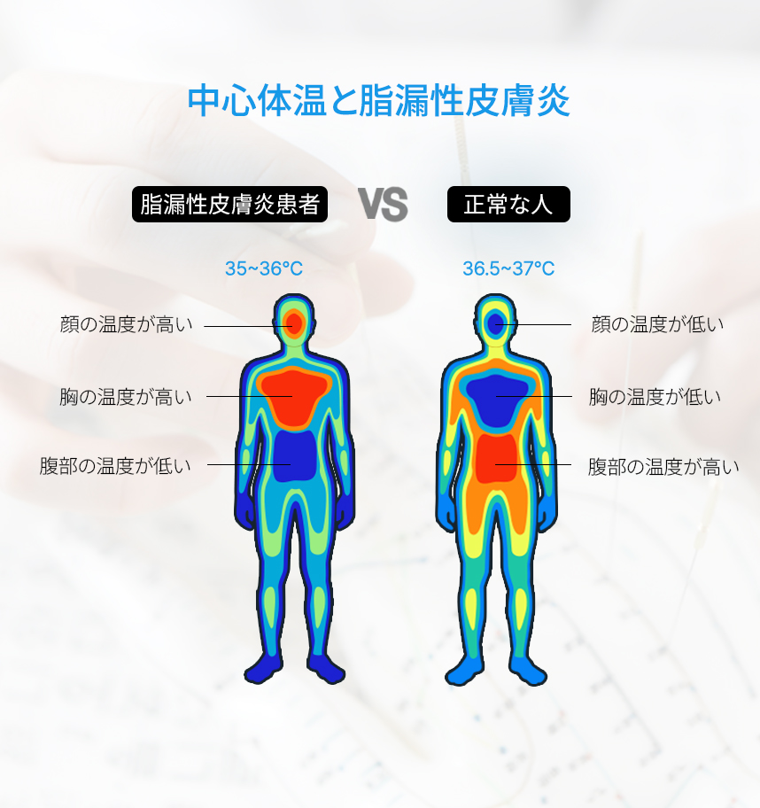 Core Body Temperatureand seborrheic dermatitis