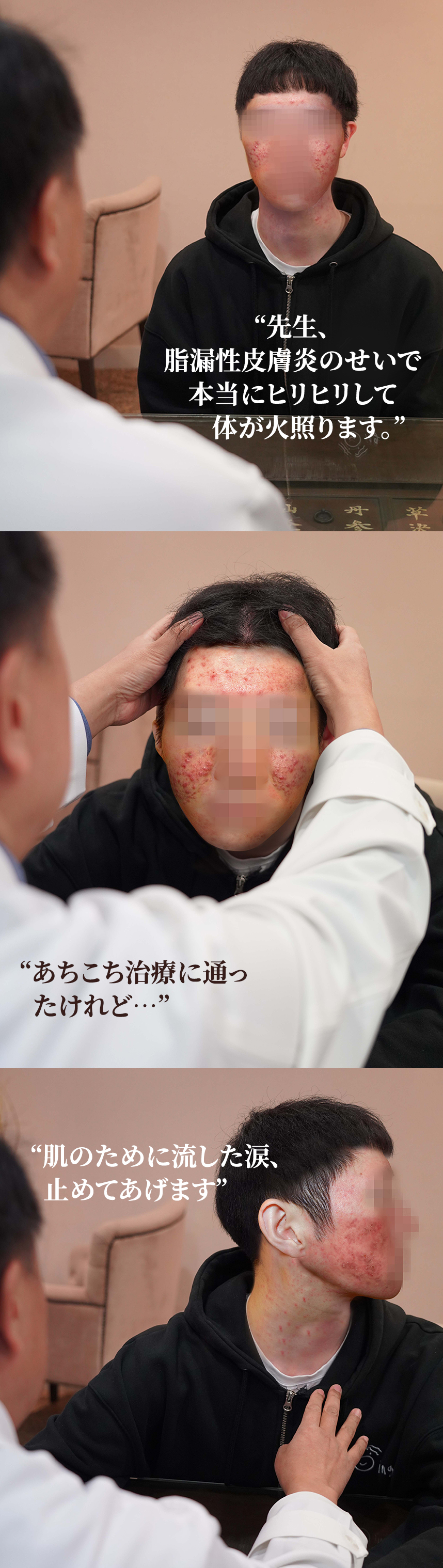 Doctor, my seborrheic dermatitis is so painful and burning. I’ve tried treatments at various places... Stop shedding tears over your skin.