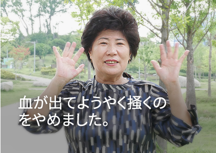 I would only stop scratching once I started bleeding.