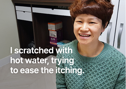 가려움에 뜨거운 물로 지지듯이 씻었어요.