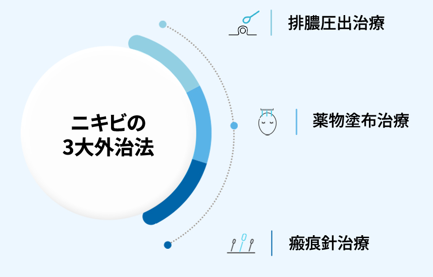 The Three Major External Treatments for acne