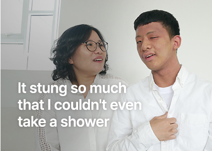 따가워서 샤워는 엄두도 못 냈어요.