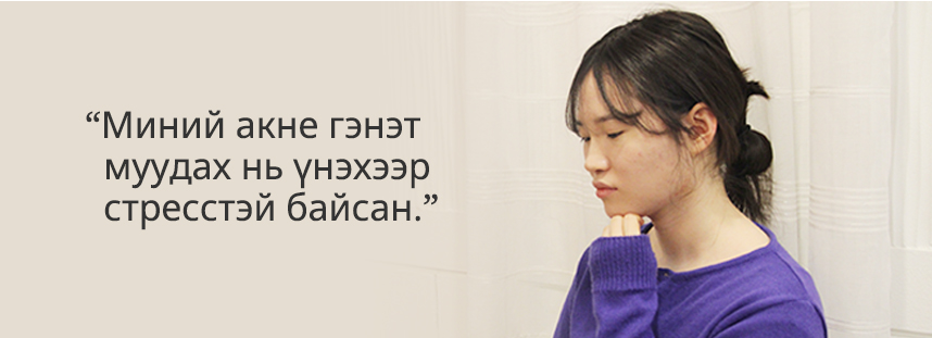Миний акне гэнэт муудах нь үнэхээр стресстэй байсан.