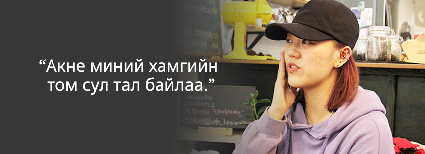 Акне миний хамгийн том сул тал байлаа.