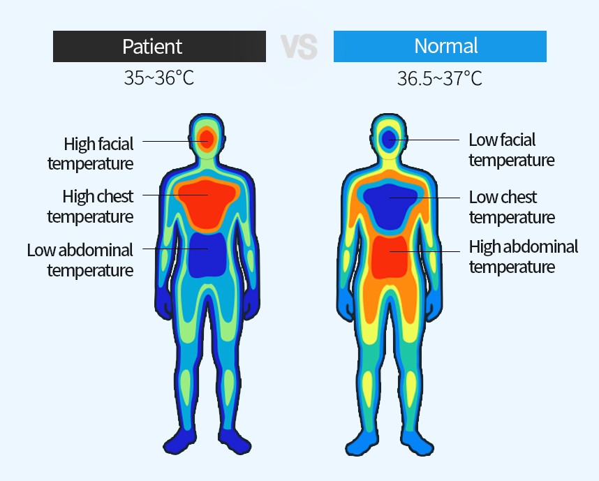 약물도포치료를 받는 아토피환자