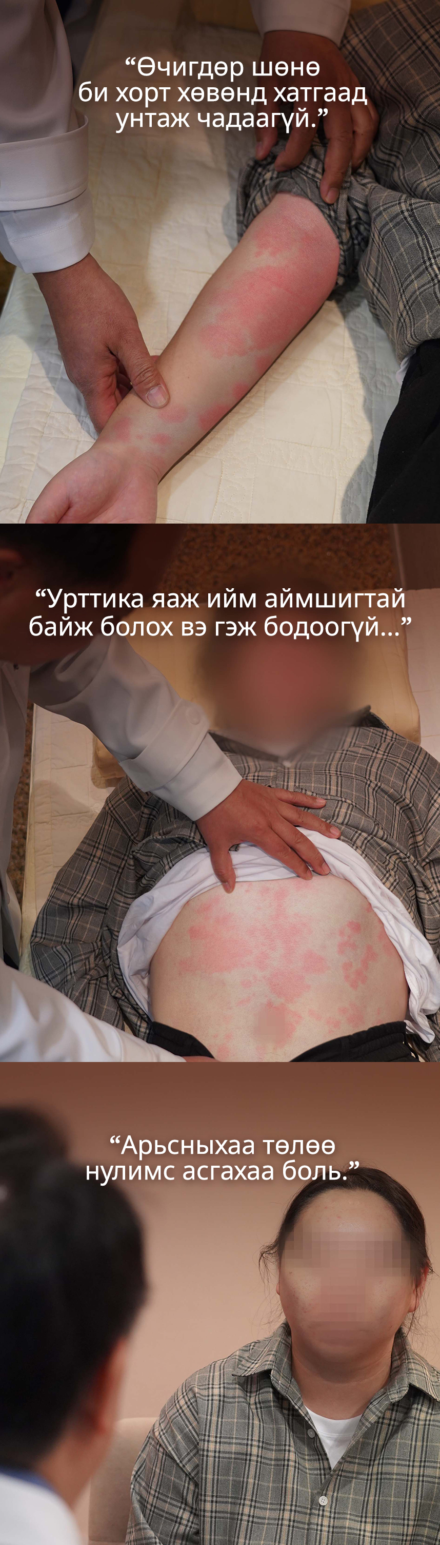 Өчигдөр шөнө би хорт хөвөнд хатгаад унтаж чадаагүй.