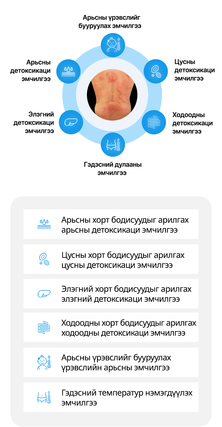 Арьсны детоксикаци эмчилгээ, Цусны детоксикаци эмчилгээ, Элэгний детоксикаци эмчилгээ, Ходоодны детоксикаци эмчилгээ, Арьсны үрэвслийг бууруулах эмчилгээ, Гэдэсний дулааны эмчилгээ