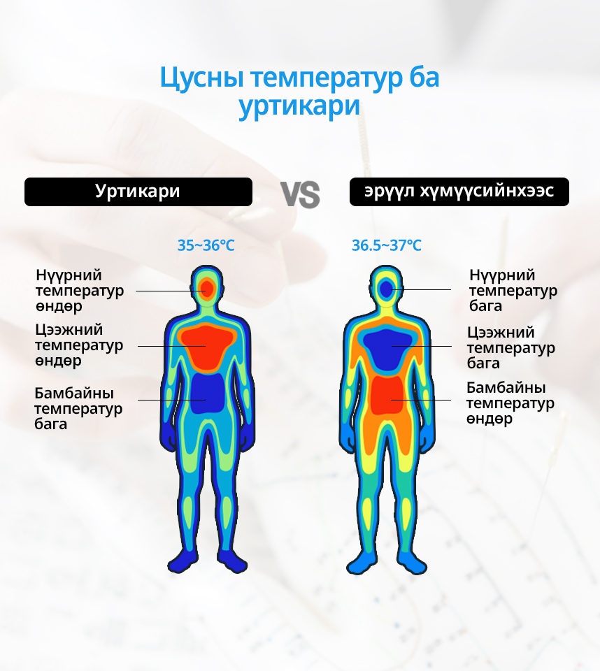 Цусны температур ба Уртикари
