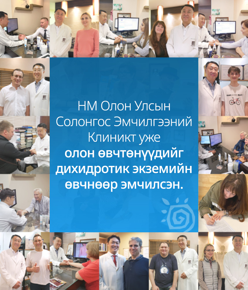 HM Олон Улсын Солонгос Эмчилгээний Клиникт уже олон өвчтөнүүдийг Дихидротик экземийн өвчнөөр эмчилсэн.