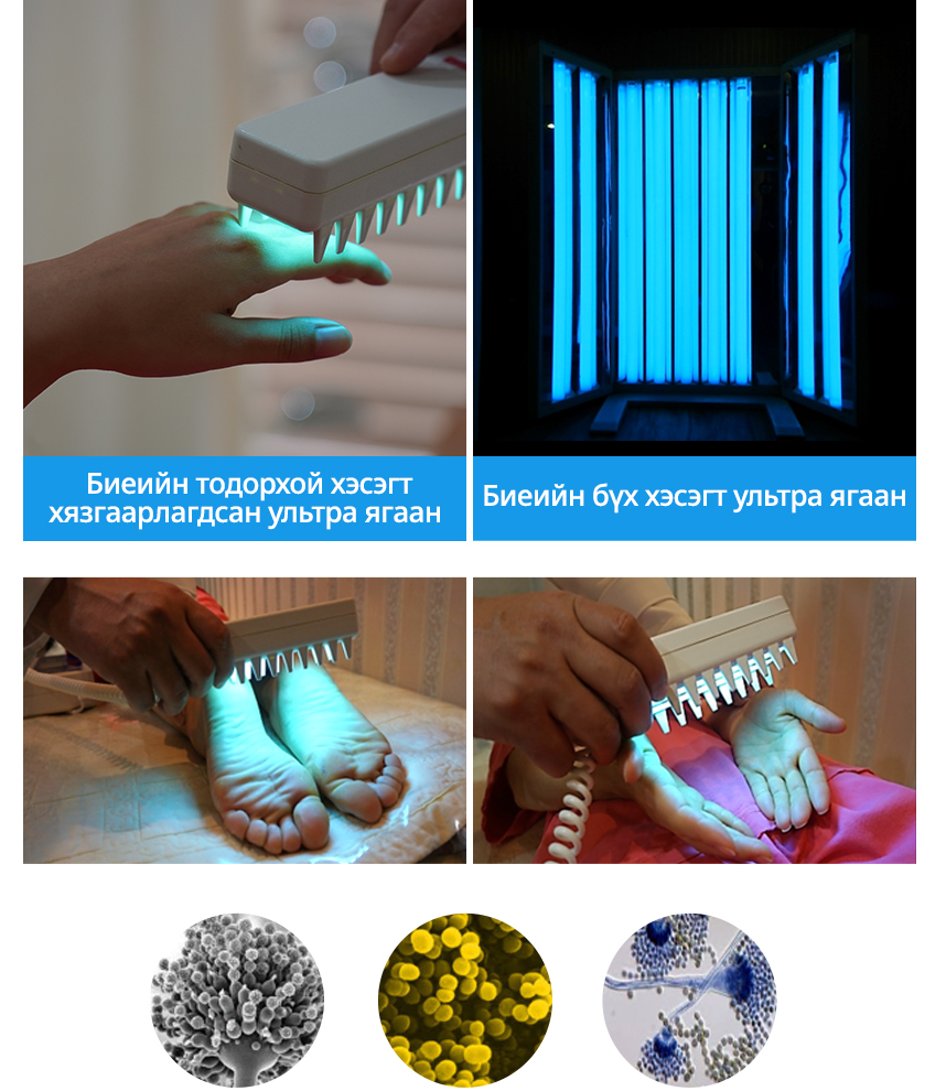 Биеийн тодорхой хэсэгт хязгаарлагдсан ультра ягаан, Биеийн бүх хэсэгт ультра ягаан