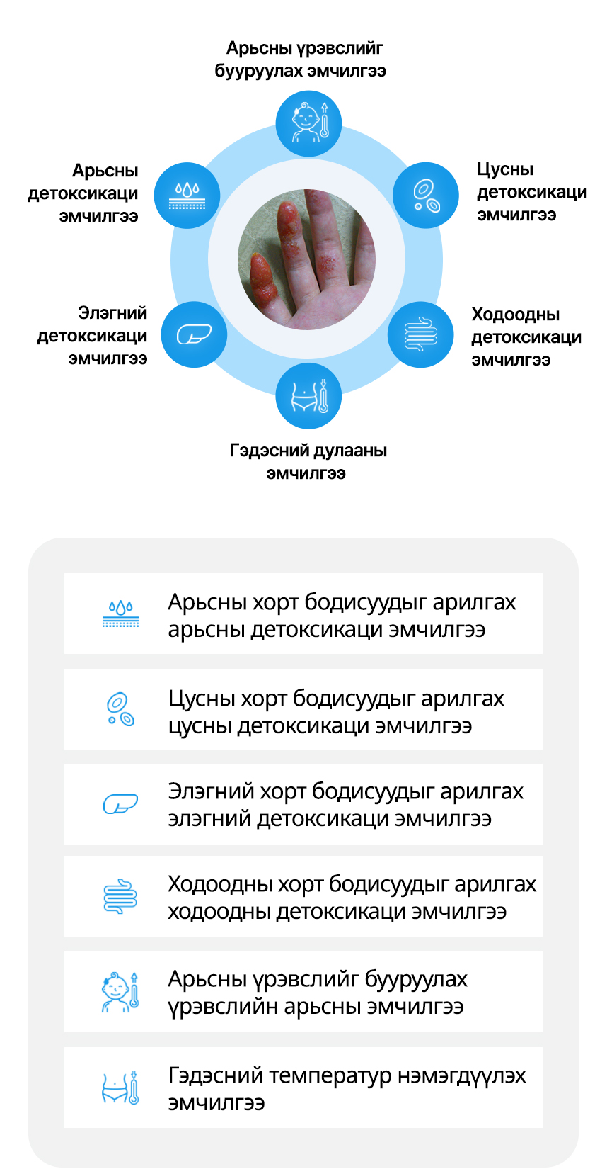 Арьсны детоксикаци эмчилгээ, Цусны детоксикаци эмчилгээ, Элэгний детоксикаци эмчилгээ, Ходоодны детоксикаци эмчилгээ, Арьсны үрэвслийг бууруулах эмчилгээ, Гэдэсний дулааны эмчилгээ