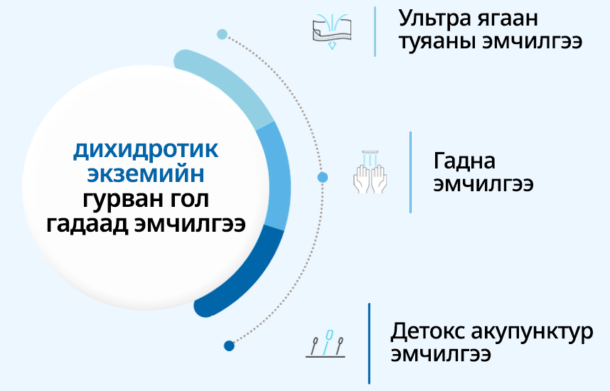 Дихидротик экземийн гурван гол гадаад эмчилгээ : Ультра ягаан туяаны эмчилгээ, Гадна эмчилгээ, Детокс акупунктур эмчилгээ