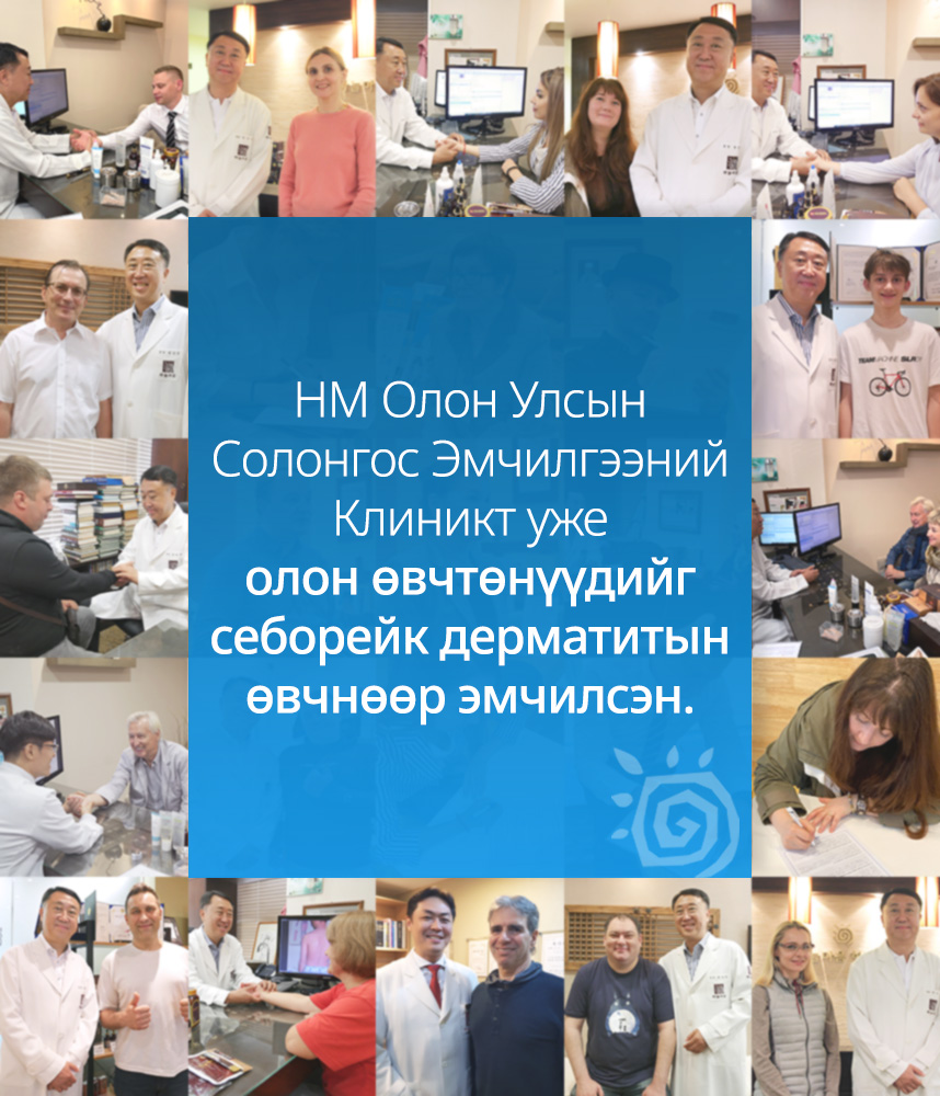 HM Олон Улсын Солонгос Эмчилгээний Клиникт уже олон өвчтөнүүдийг Себорейк дерматитын өвчнөөр эмчилсэн.