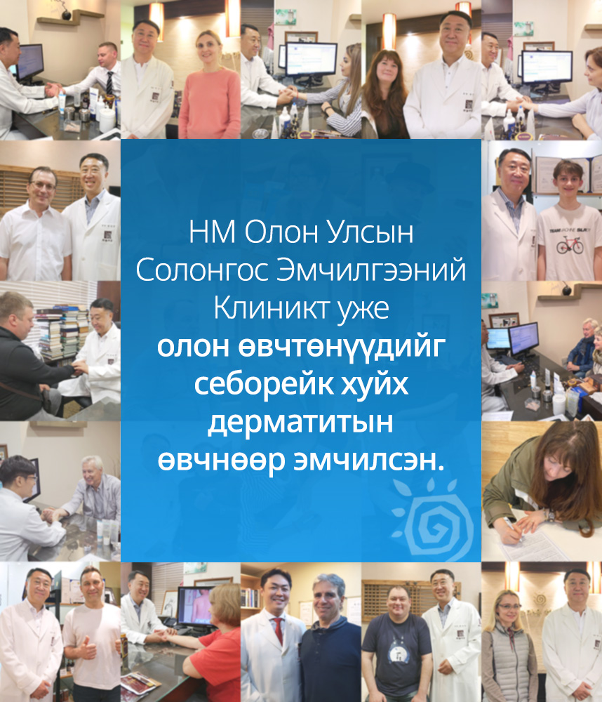 HM Олон Улсын Солонгос Эмчилгээний Клиникт уже олон өвчтөнүүдийг Себорейк хуйх дерматитын өвчнөөр эмчилсэн.