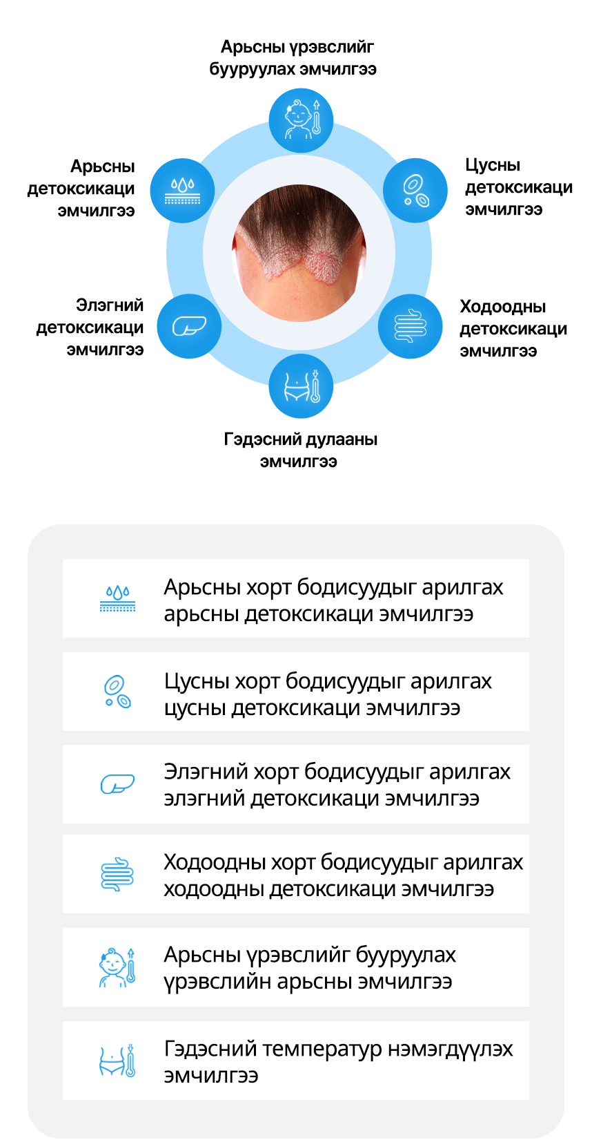 Арьсны детоксикаци эмчилгээ, Цусны детоксикаци эмчилгээ, Элэгний детоксикаци эмчилгээ, Ходоодны детоксикаци эмчилгээ, Арьсны үрэвслийг бууруулах эмчилгээ, Гэдэсний дулааны эмчилгээ