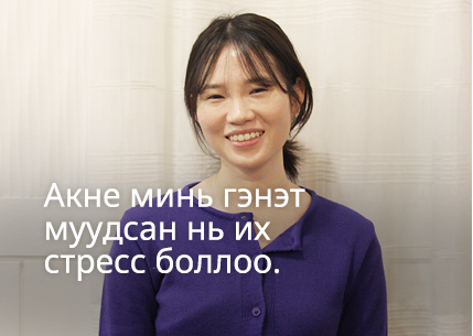 Акне минь гэнэт муудсан нь их стресс боллоо. 