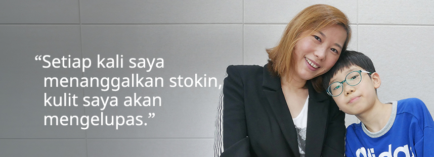 Setiap kali saya menanggalkan stokin, kulit saya akan mengelupas.