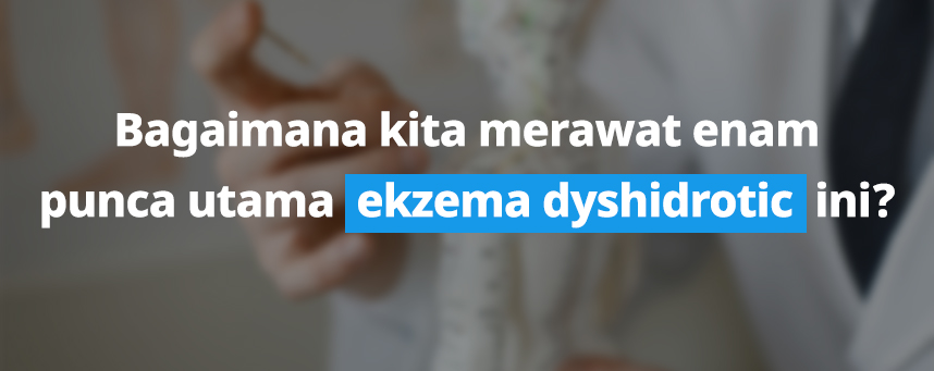 Bagaimana kita merawat enam punca utama ekzema dyshidrotic ini?