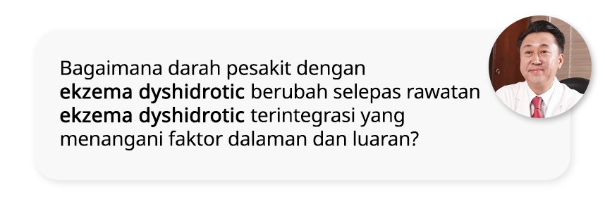 Bagaimana darah pesakit dengan ekzema dyshidrotic berubah selepas rawatan ekzema dyshidrotic terintegrasi yang menangani faktor dalaman dan luaran?