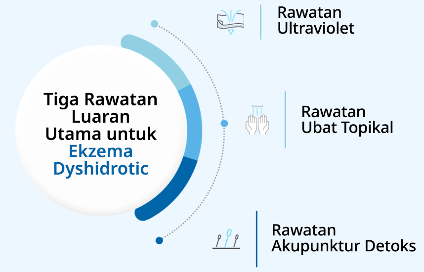 Tiga Rawatan Luaran Utama untuk ekzema dyshidrotic