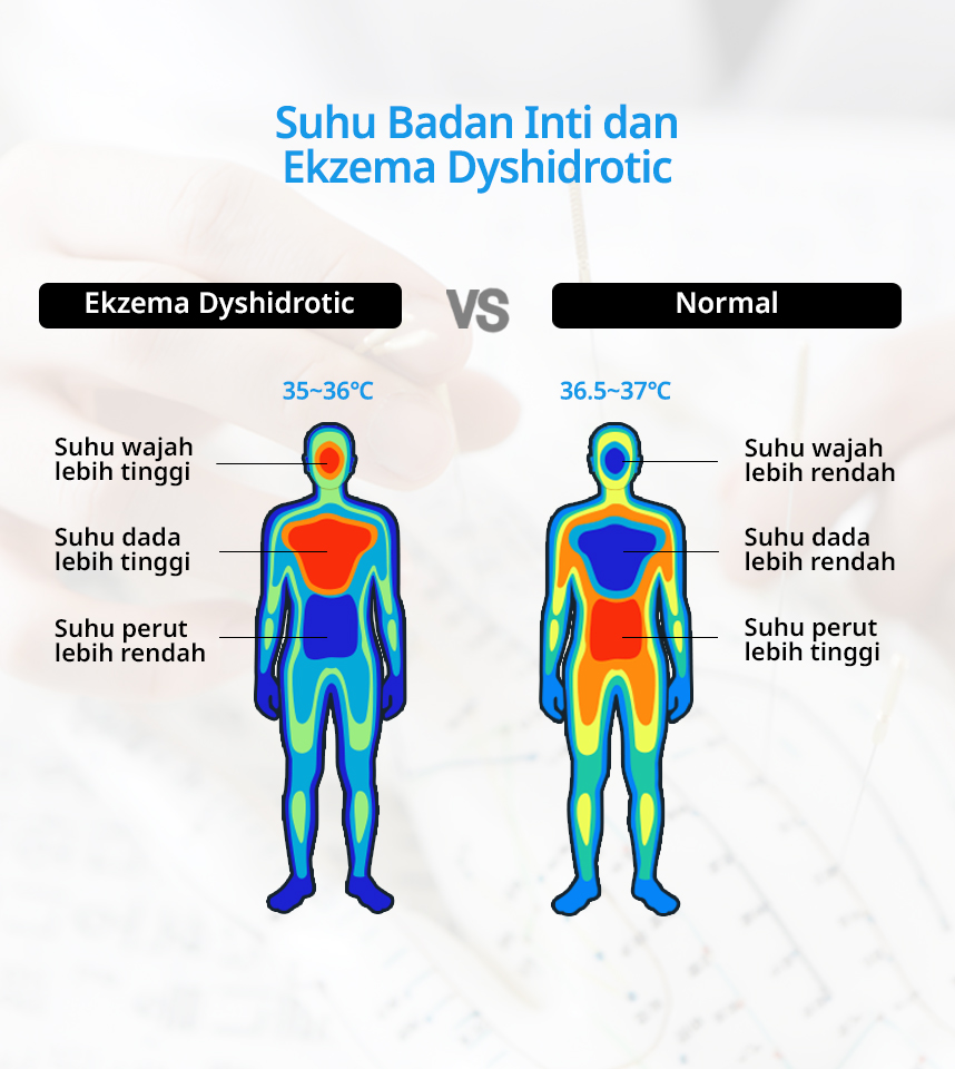 Suhu Badan Inti dan ekzema dyshidrotic