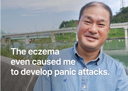 습진 때문에 공황장애까지 생겼어요.