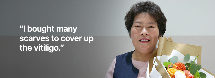 백반증을 가리기 위해 스카프를 많이 샀어요.