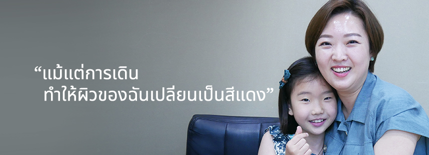 แม้แต่การเดินทำให้ผิวของฉันเปลี่ยนเป็นสีแดง